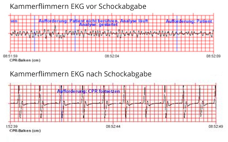 Projekt-oeffentliche-Defibrillatoren-AED-Herzpraxis-Schwyz-Herzspezialist